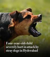 Dog Attacks Kid